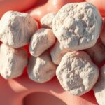 prostate gland stone